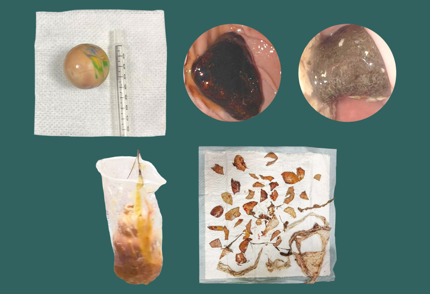 Photos of various gastric foreign bodies that have been removed from pets.