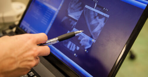 Photo of a hand holding a pen pointing to dental x-rays on a computer screen